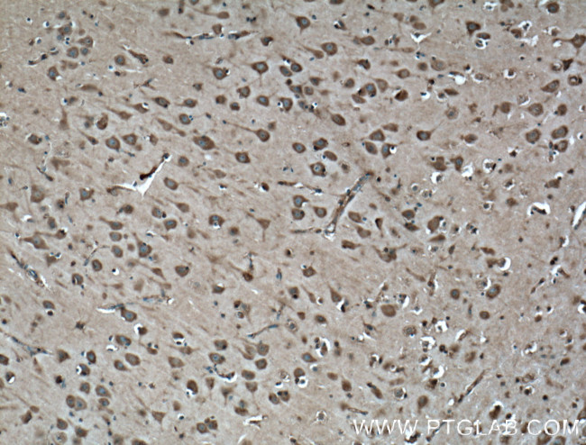 Synaptophysin Antibody in Immunohistochemistry (Paraffin) (IHC (P))