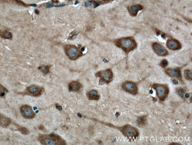 Synaptophysin Antibody in Immunohistochemistry (Paraffin) (IHC (P))