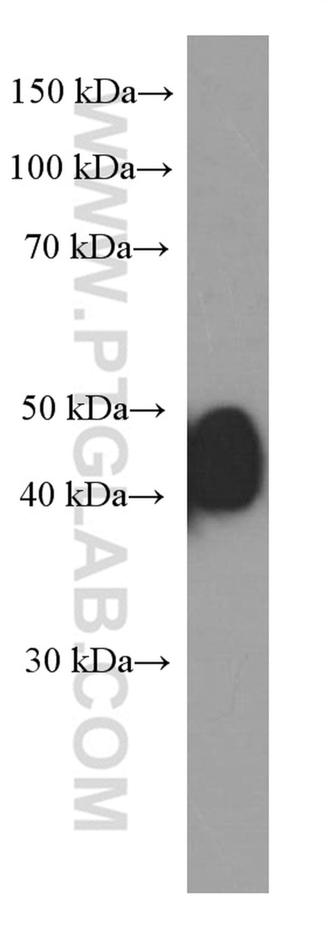 ESR2 Antibody in Western Blot (WB)