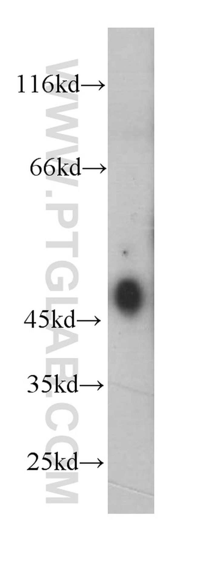 ESR2 Antibody in Western Blot (WB)