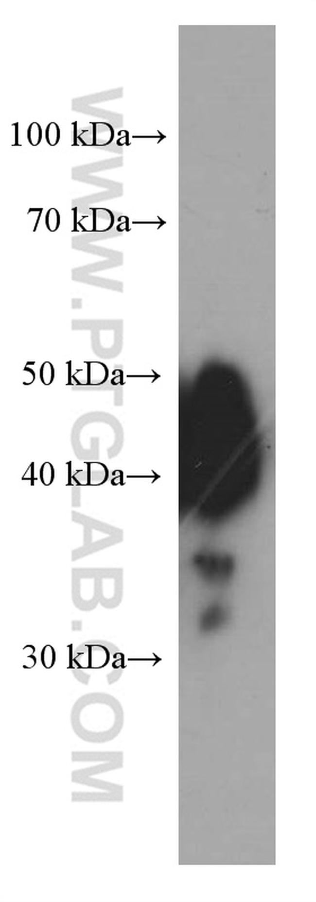 ESR2 Antibody in Western Blot (WB)