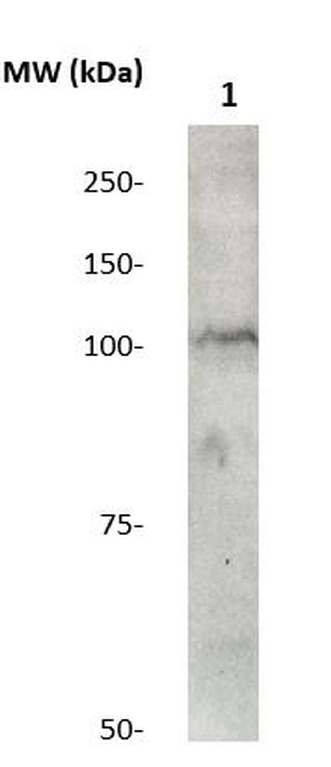 Catenin-Delta1 Antibody in Western Blot (WB)