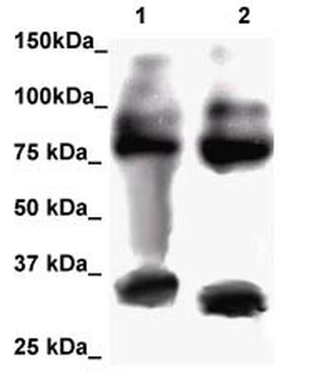 FOXP2 Antibody in Western Blot (WB)