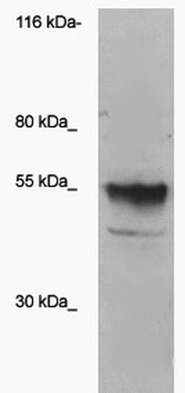 Sialyltransferase Antibody in Western Blot (WB)