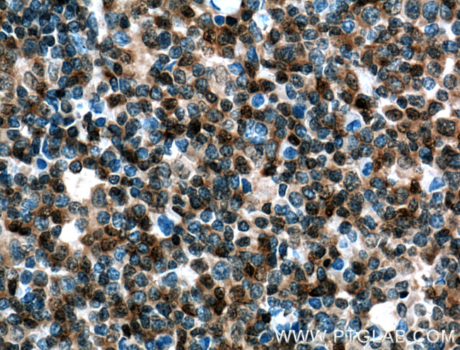 UBC9 Antibody in Immunohistochemistry (Paraffin) (IHC (P))