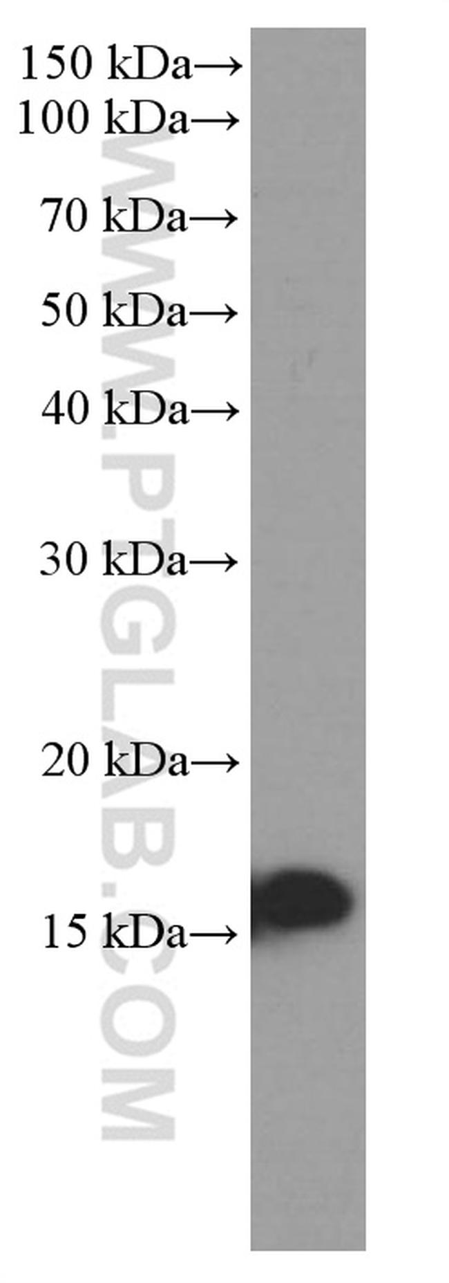 UBC9 Antibody in Western Blot (WB)