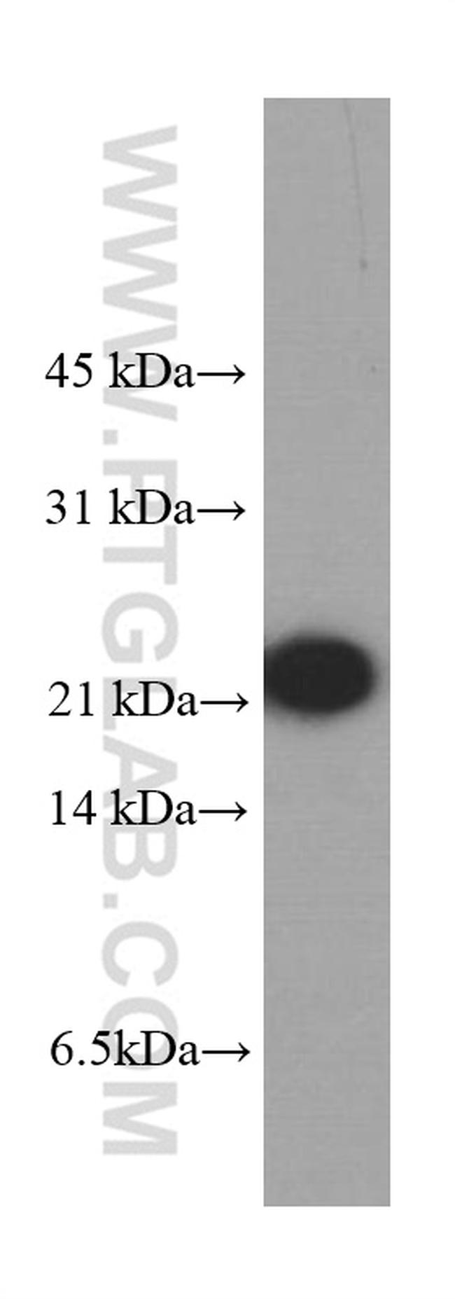 peroxiredoxin 2 Antibody in Western Blot (WB)