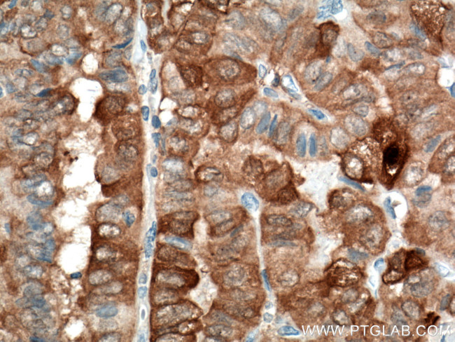 Galectin-3 Antibody in Immunohistochemistry (Paraffin) (IHC (P))