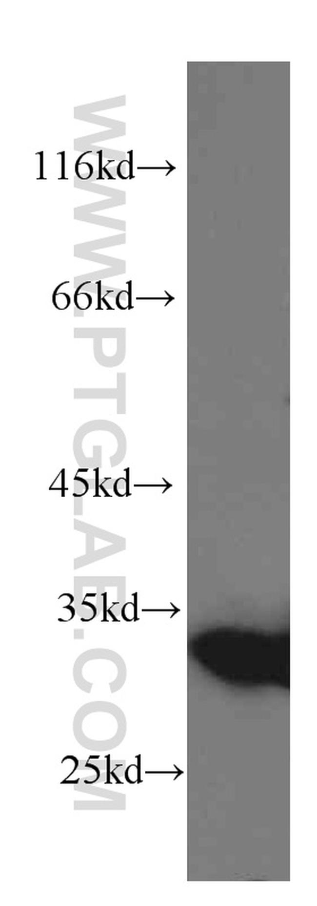 Galectin-3 Antibody in Western Blot (WB)