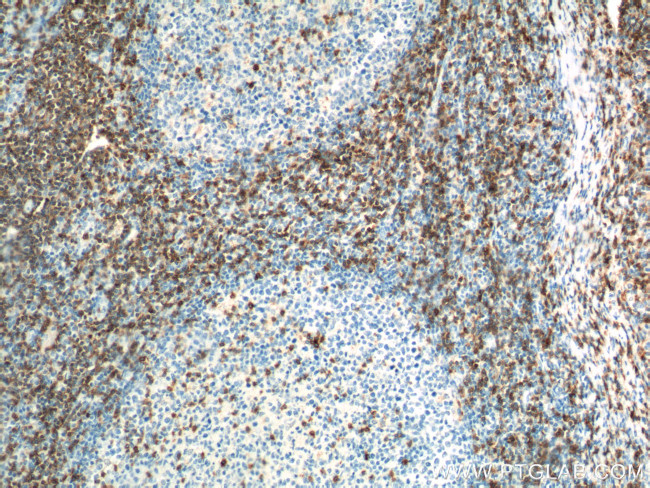 CD7 Antibody in Immunohistochemistry (Paraffin) (IHC (P))