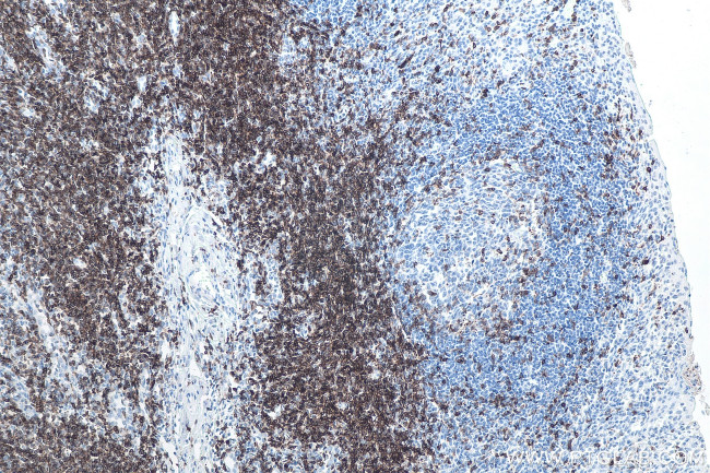 CD7 Antibody in Immunohistochemistry (Paraffin) (IHC (P))