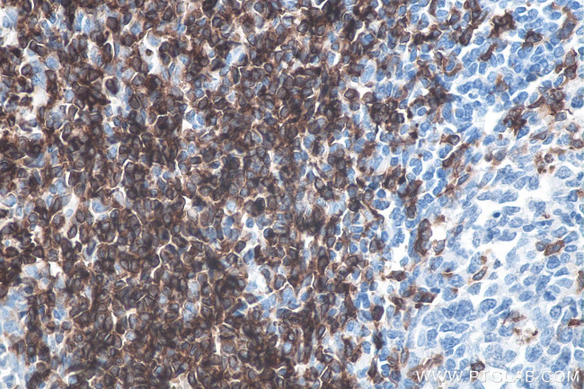 CD7 Antibody in Immunohistochemistry (Paraffin) (IHC (P))