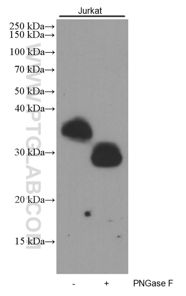 CD7 Antibody in Western Blot (WB)