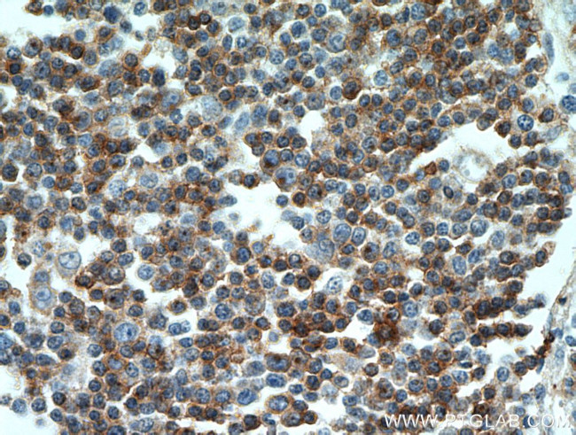 CD7 Antibody in Immunohistochemistry (Paraffin) (IHC (P))