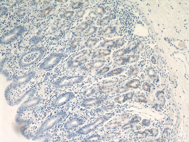 FUT9 Antibody in Immunohistochemistry (Paraffin) (IHC (P))