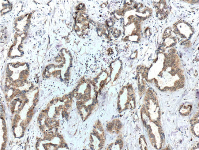 FUT9 Antibody in Immunohistochemistry (Paraffin) (IHC (P))