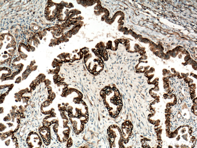 CD9 Antibody in Immunohistochemistry (Paraffin) (IHC (P))