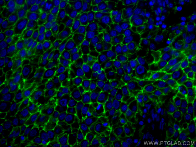 CD9 Antibody in Immunohistochemistry (PFA fixed) (IHC (PFA))