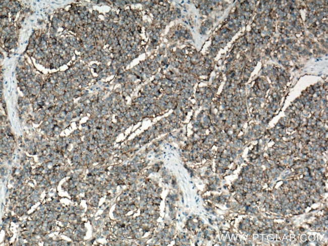 CD9 Antibody in Immunohistochemistry (Paraffin) (IHC (P))