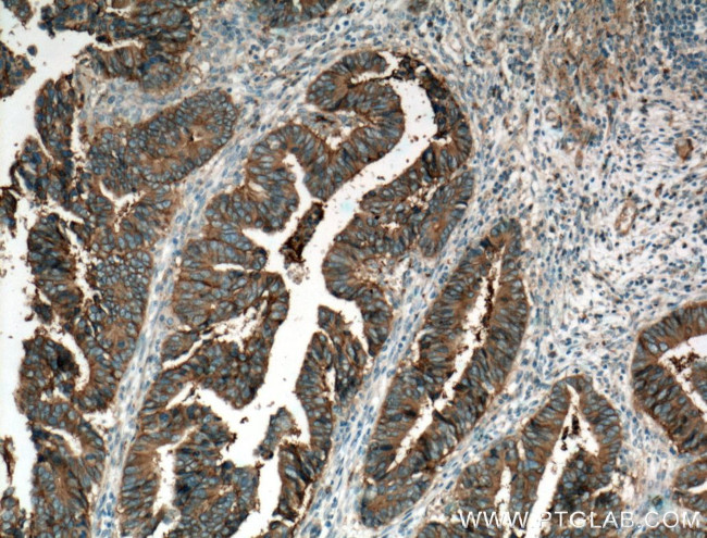 CD9 Antibody in Immunohistochemistry (Paraffin) (IHC (P))