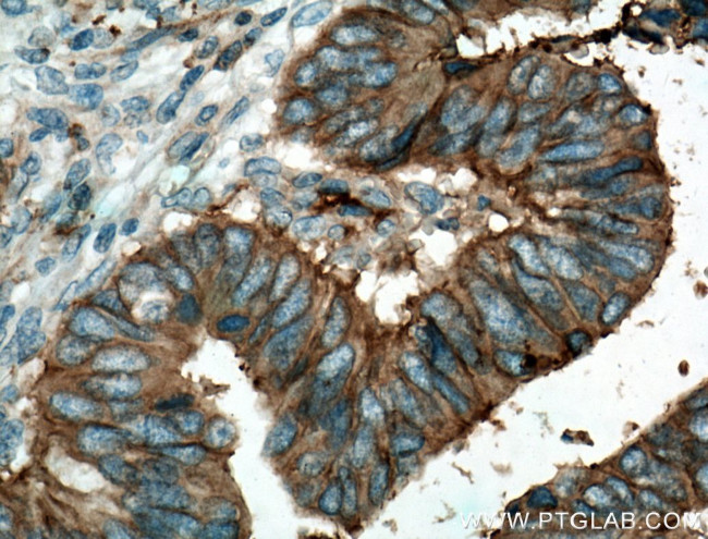 CD9 Antibody in Immunohistochemistry (Paraffin) (IHC (P))