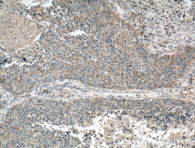 Gamma cystathionase Antibody in Immunohistochemistry (Paraffin) (IHC (P))