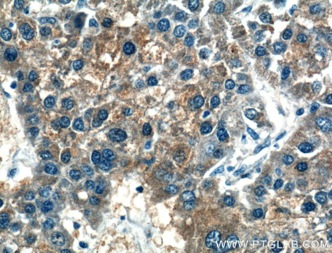 Gamma cystathionase Antibody in Immunohistochemistry (Paraffin) (IHC (P))