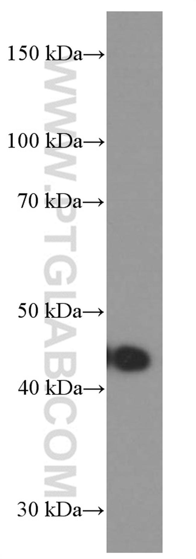 Gamma cystathionase Antibody in Western Blot (WB)