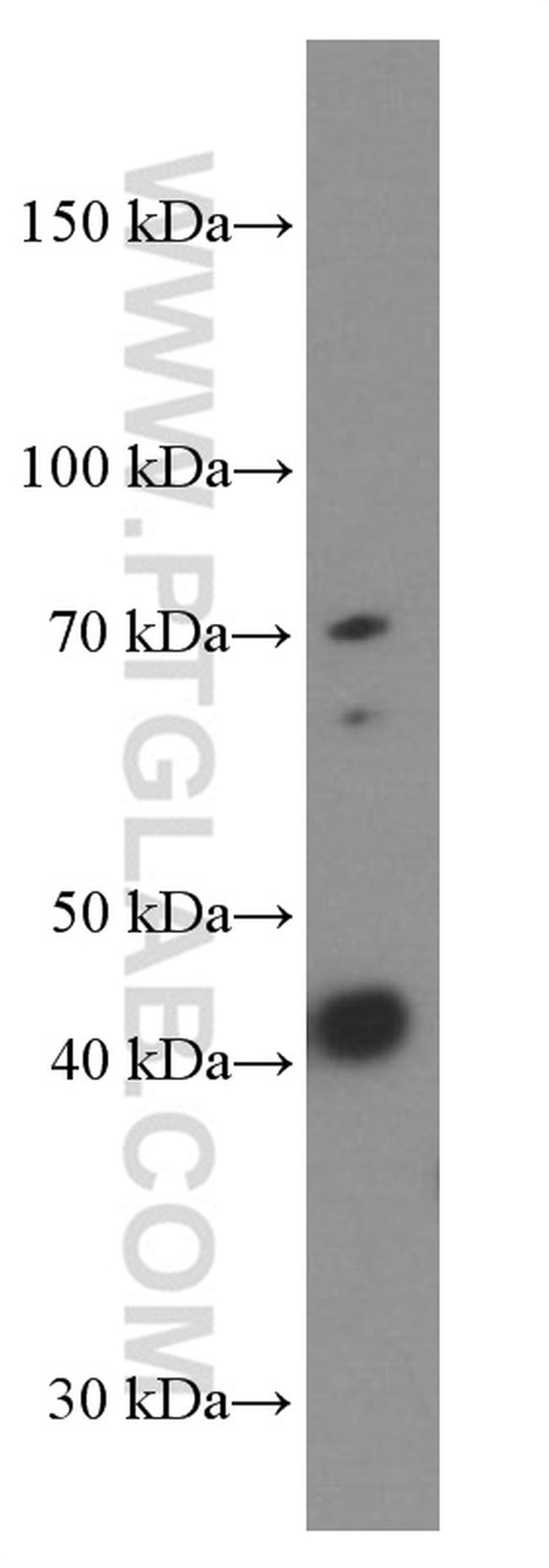 Gamma cystathionase Antibody in Western Blot (WB)