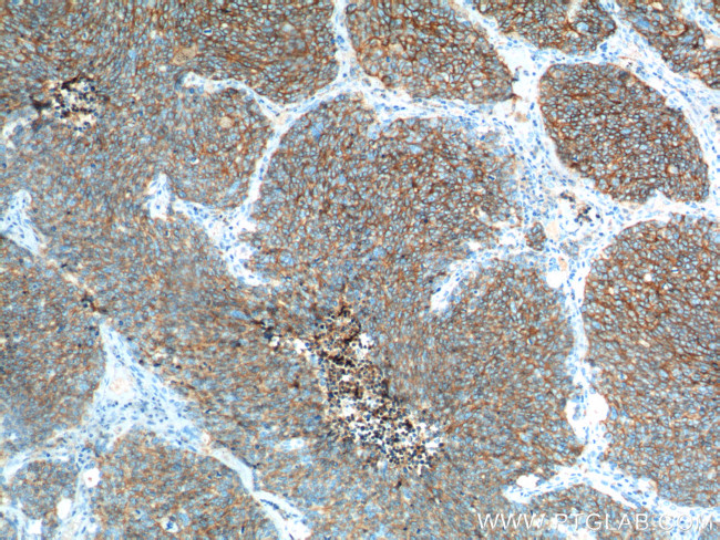 NCAM1/CD56 Antibody in Immunohistochemistry (Paraffin) (IHC (P))