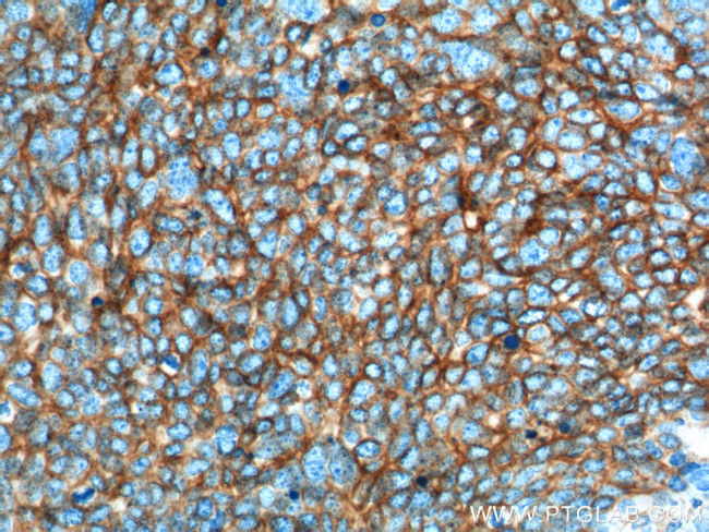 NCAM1/CD56 Antibody in Immunohistochemistry (Paraffin) (IHC (P))