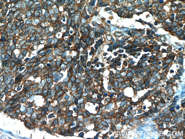 NCAM1/CD56 Antibody in Immunohistochemistry (Paraffin) (IHC (P))