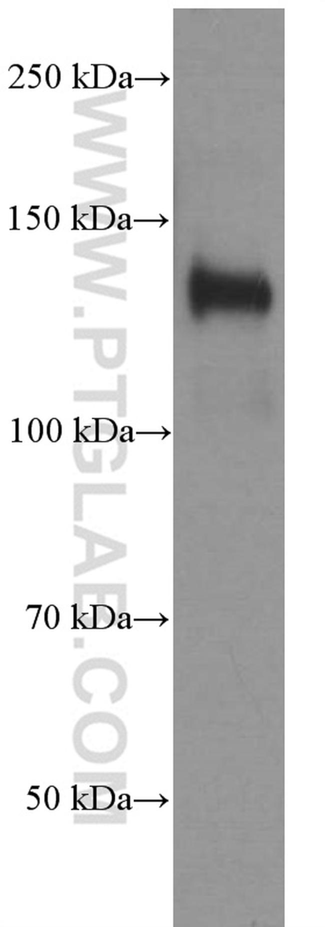 NCAM1/CD56 Antibody in Western Blot (WB)