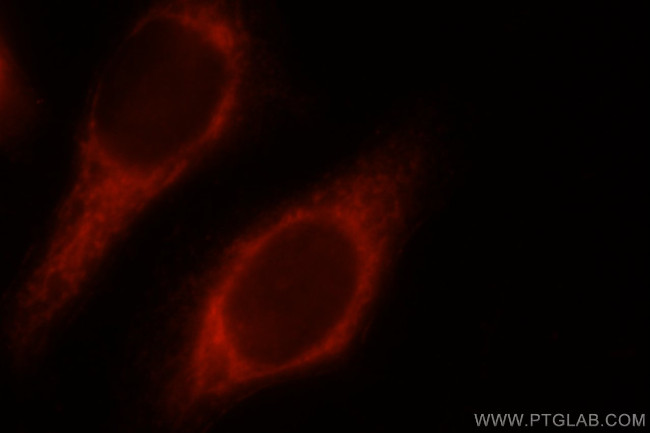 COXIV Antibody in Immunocytochemistry (ICC/IF)