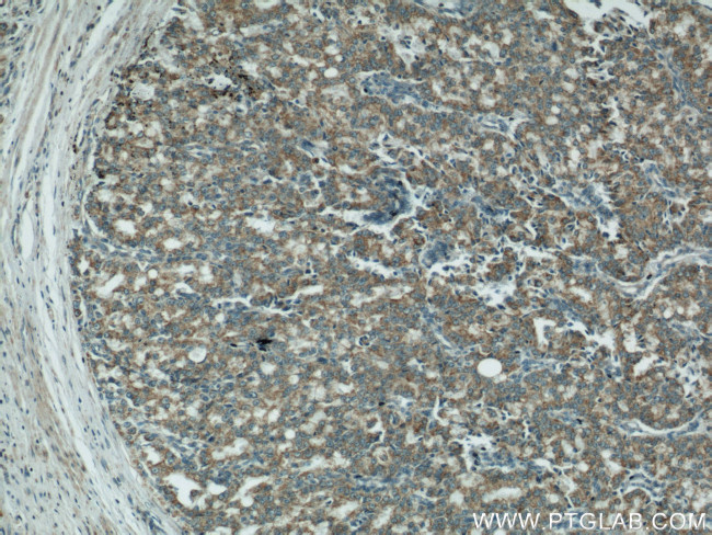 COXIV Antibody in Immunohistochemistry (Paraffin) (IHC (P))