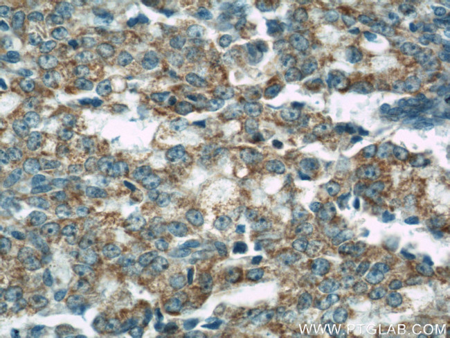 COXIV Antibody in Immunohistochemistry (Paraffin) (IHC (P))