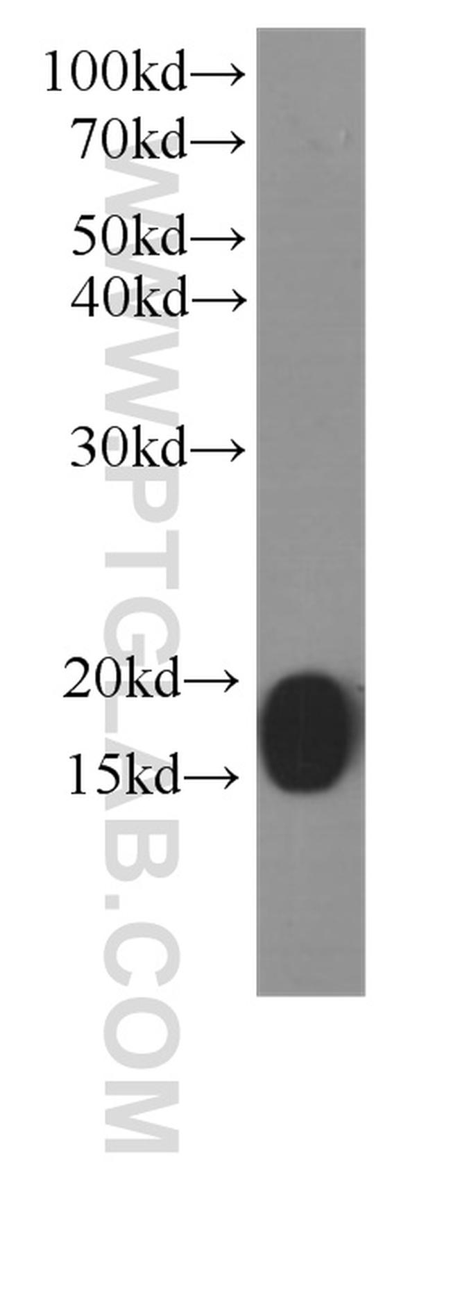 COXIV Antibody in Western Blot (WB)