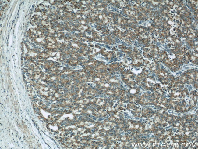 COXIV Antibody in Immunohistochemistry (Paraffin) (IHC (P))