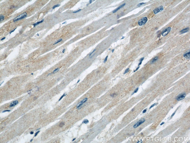 COXIV Antibody in Immunohistochemistry (Paraffin) (IHC (P))