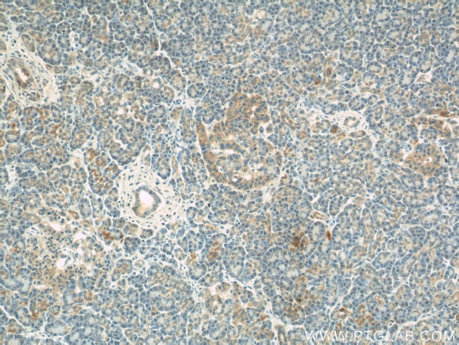 COXIV Antibody in Immunohistochemistry (Paraffin) (IHC (P))