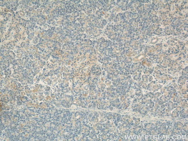 COXIV Antibody in Immunohistochemistry (Paraffin) (IHC (P))