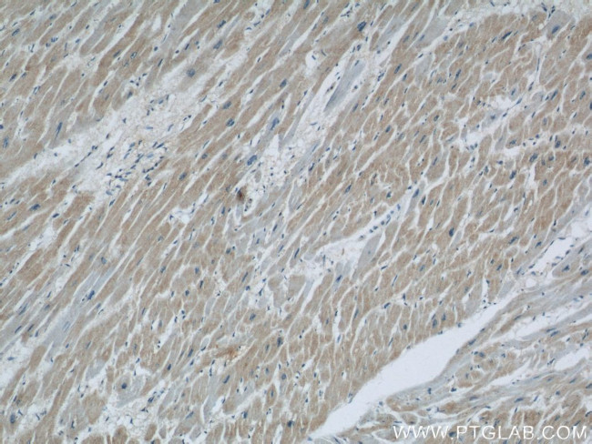 COXIV Antibody in Immunohistochemistry (Paraffin) (IHC (P))