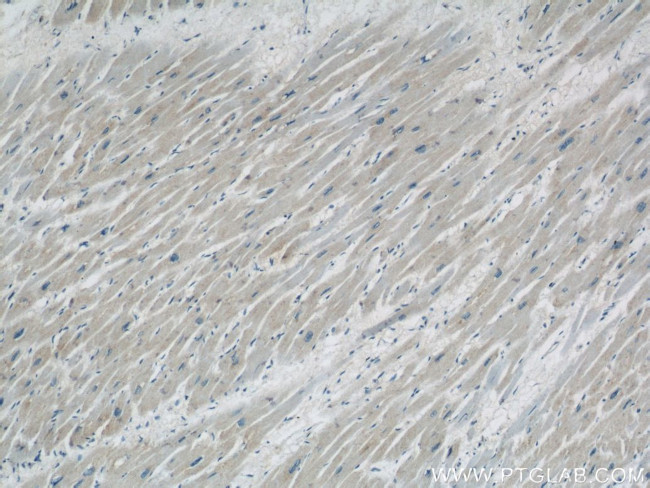 COXIV Antibody in Immunohistochemistry (Paraffin) (IHC (P))