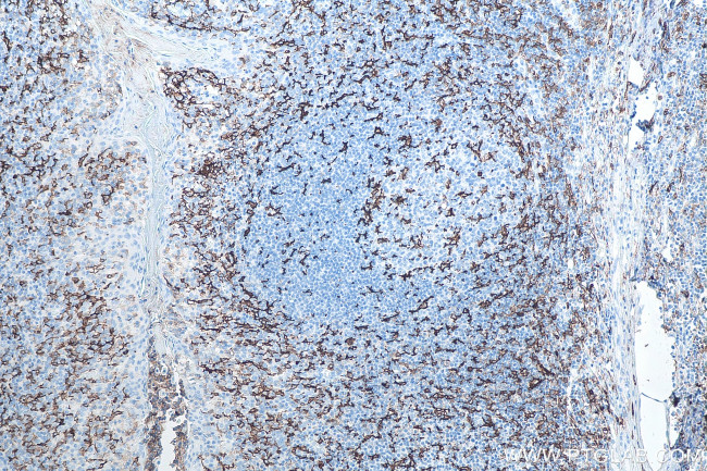 CD11c/Integrin alpha X Antibody in Immunohistochemistry (Paraffin) (IHC (P))