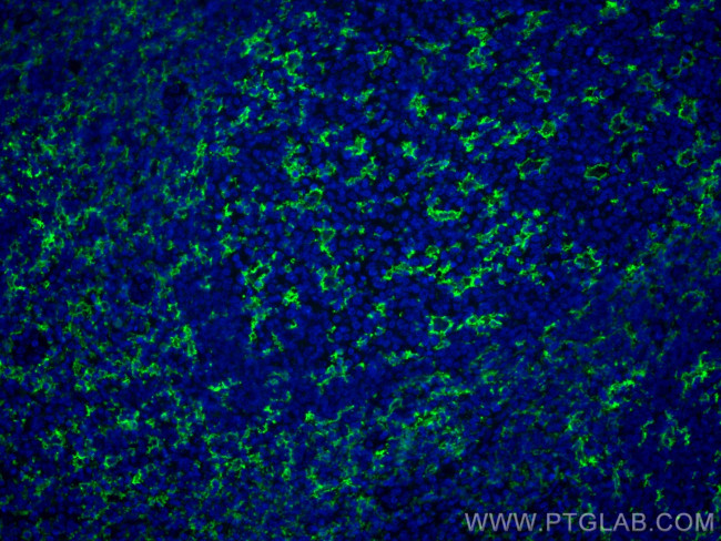 CD11c/Integrin alpha X Antibody in Immunohistochemistry (PFA fixed) (IHC (PFA))