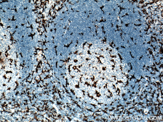 CD11c/Integrin alpha X Antibody in Immunohistochemistry (Paraffin) (IHC (P))