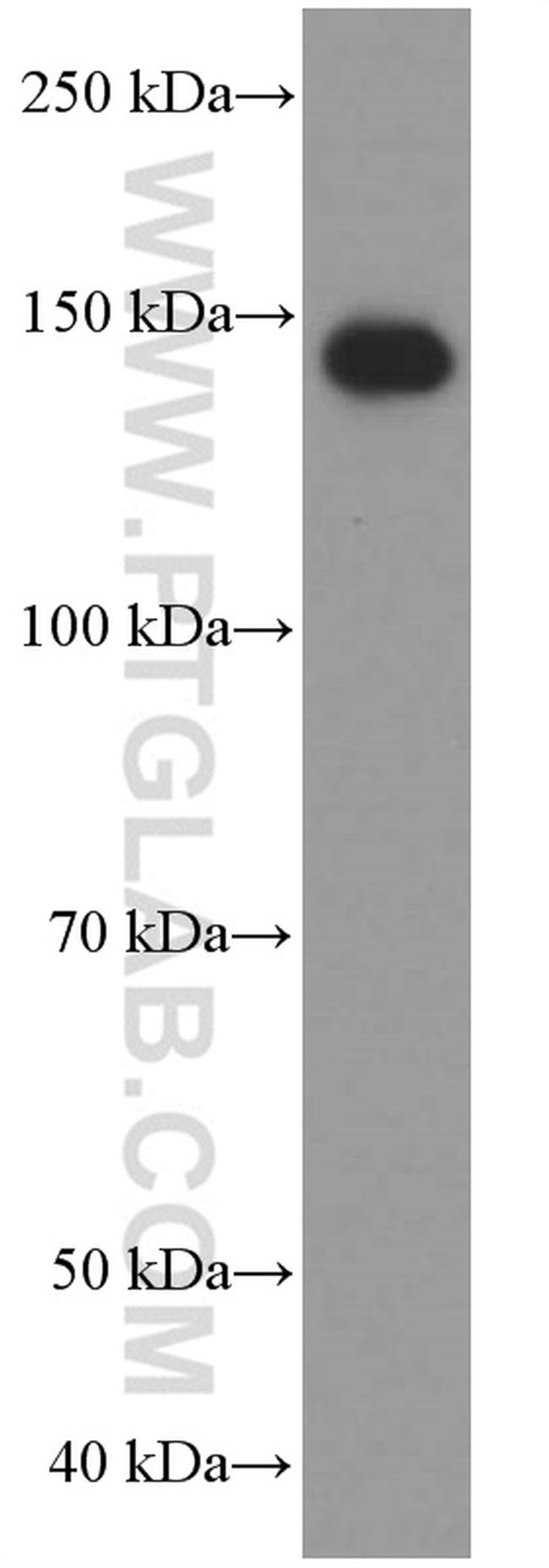 CD11c/Integrin alpha X Antibody in Western Blot (WB)