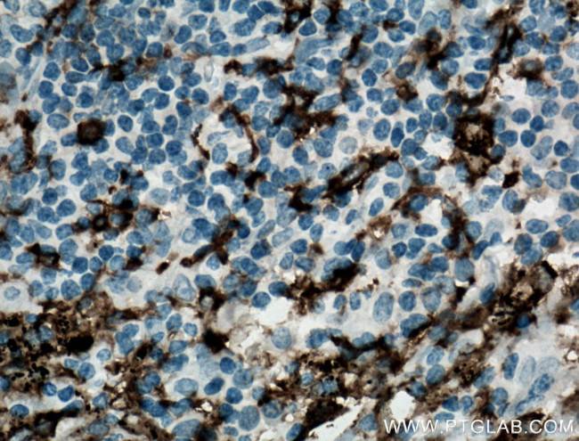 CD11c/Integrin alpha X Antibody in Immunohistochemistry (Paraffin) (IHC (P))