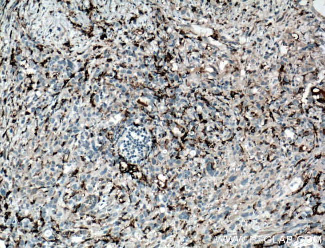 CD11c/Integrin alpha X Antibody in Immunohistochemistry (Paraffin) (IHC (P))