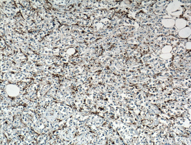 CD11c/Integrin alpha X Antibody in Immunohistochemistry (Paraffin) (IHC (P))